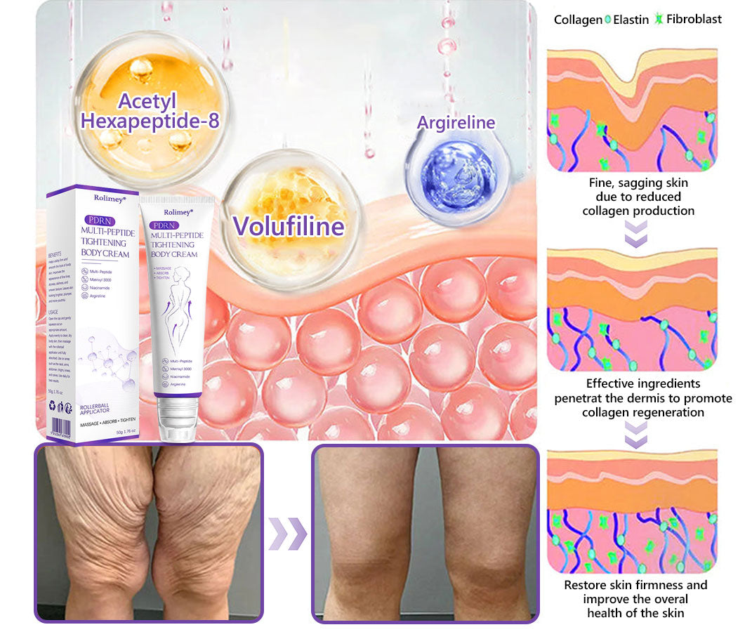✨Rolimey® PDRN Multi-Peptide Massaging Roller Cream - Anti-aging, Hydrating, Skin Firming & Lifting, Skin Repair, Even Tone, Acne and Dark Spot Treatment, Wart and Mole Removal, and Psoriasis Relief.