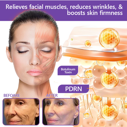 ✨Rolimey® PDRN Multi-Peptide Massaging Roller Cream - Anti-aging, Hydrating, Skin Firming & Lifting, Skin Repair, Even Tone, Acne and Dark Spot Treatment, Wart and Mole Removal, and Psoriasis Relief.