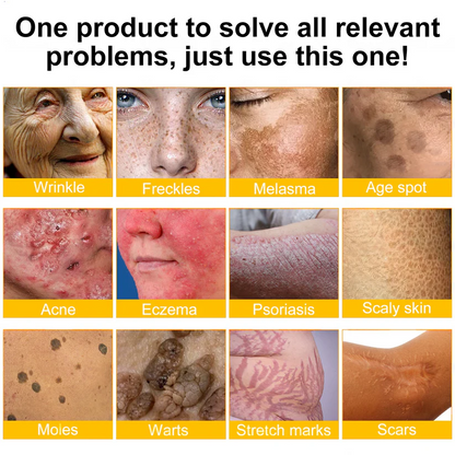 FDA Approved: Ourlyard® Bee Venom Skin Restoration Cream — 🔥Limited Time 80% OFF🔥