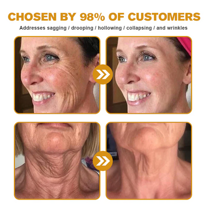 FDA Approved: Ourlyard® Bee Venom Skin Restoration Cream — 🔥Limited Time 80% OFF🔥