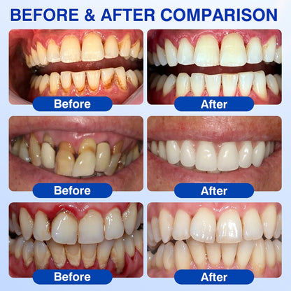 ❤️🦷Evolvion® GumVital Advanced Gum Care Gel🛡️🎁