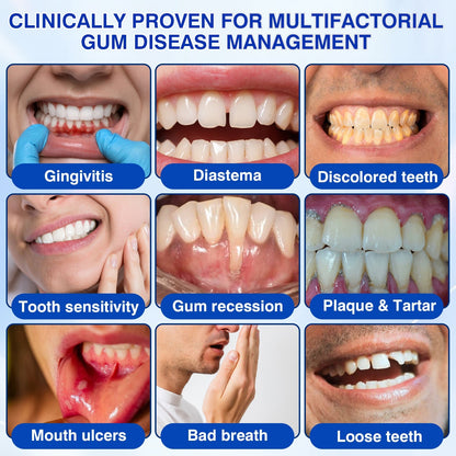 ❤️🦷Evolvion® GumVital Advanced Gum Care Gel🛡️🎁