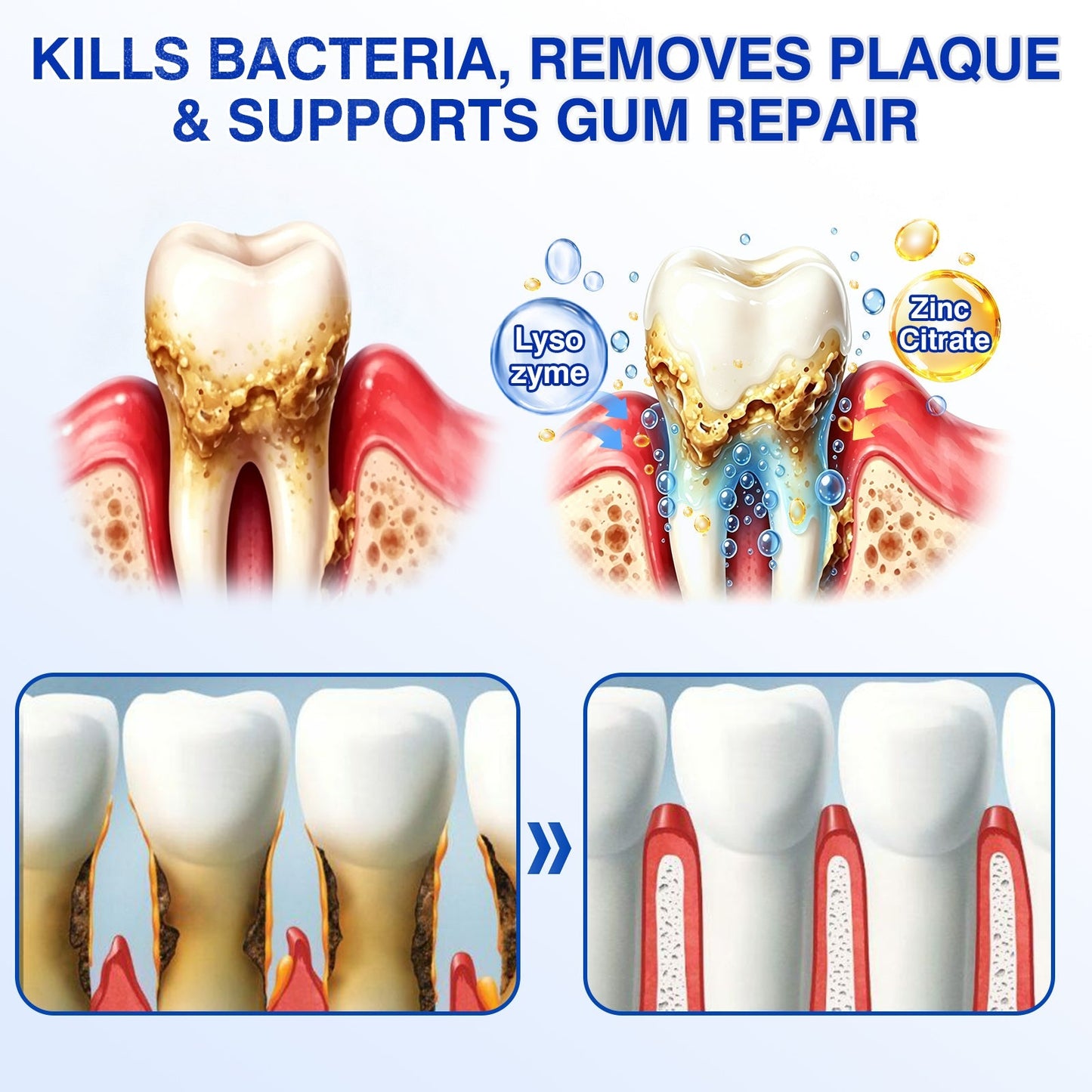 ❤️🦷Evolvion® GumVital Advanced Gum Care Gel🛡️🎁