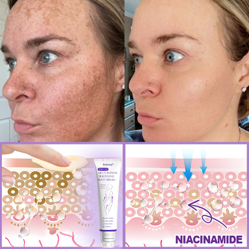 ✨Rolimey® PDRN Multi-Peptide Massaging Roller Cream - Anti-aging, Hydrating, Skin Firming & Lifting, Skin Repair, Even Tone, Acne and Dark Spot Treatment, Wart and Mole Removal, and Psoriasis Relief.