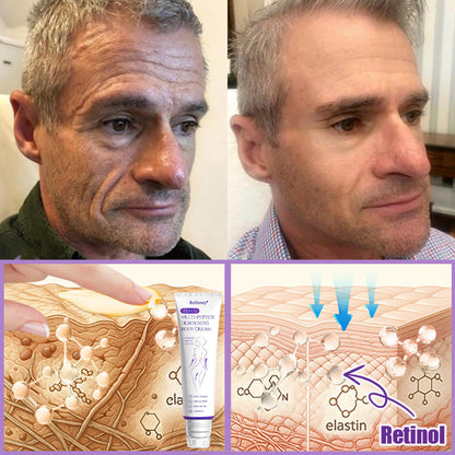 ✨Rolimey® PDRN Multi-Peptide Massaging Roller Cream - Anti-aging, Hydrating, Skin Firming & Lifting, Skin Repair, Even Tone, Acne and Dark Spot Treatment, Wart and Mole Removal, and Psoriasis Relief.