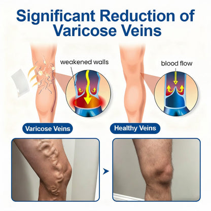🌟Enjoy 30% OFF for adding the second one - VeinEase🌟