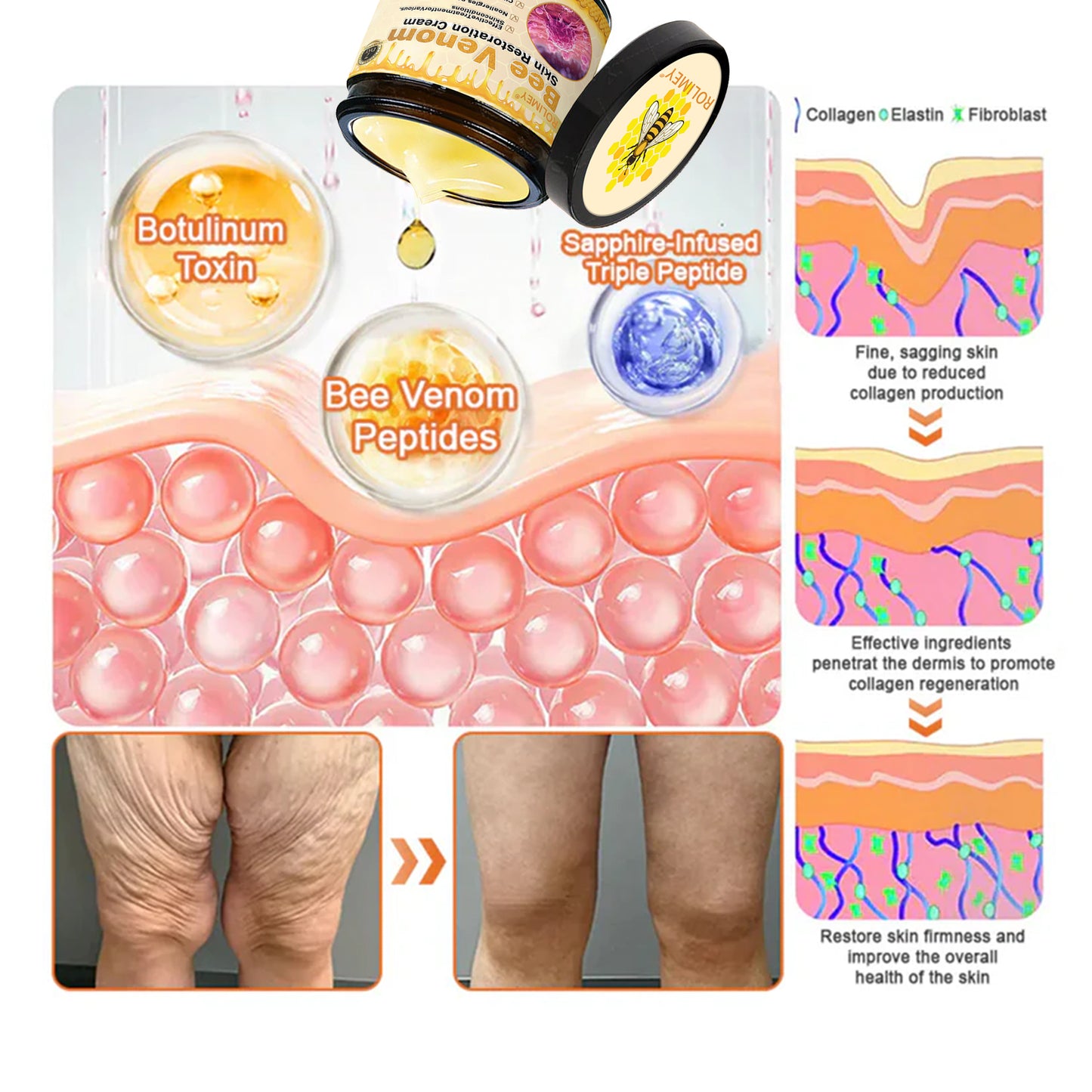 👨‍⚕️Dermatologist Recommended👨‍⚕️: Rolimey® Bee Venom Advanced Skin Rescue — Specifically Formulated for Paper-Thin, Fragile & Easy-Bruising Skin — 🔥Limited Time 80% OFF🔥