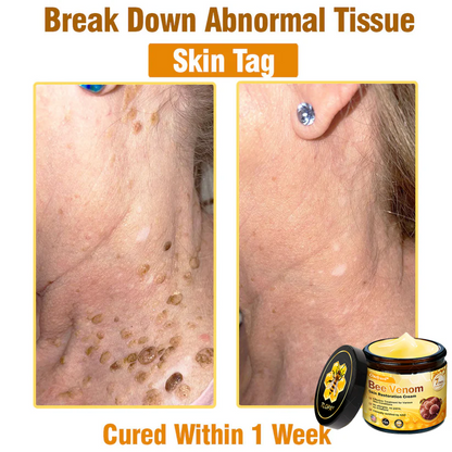 FDA Approved: Ourlyard® Bee Venom Skin Restoration Cream — 🔥Limited Time 80% OFF🔥