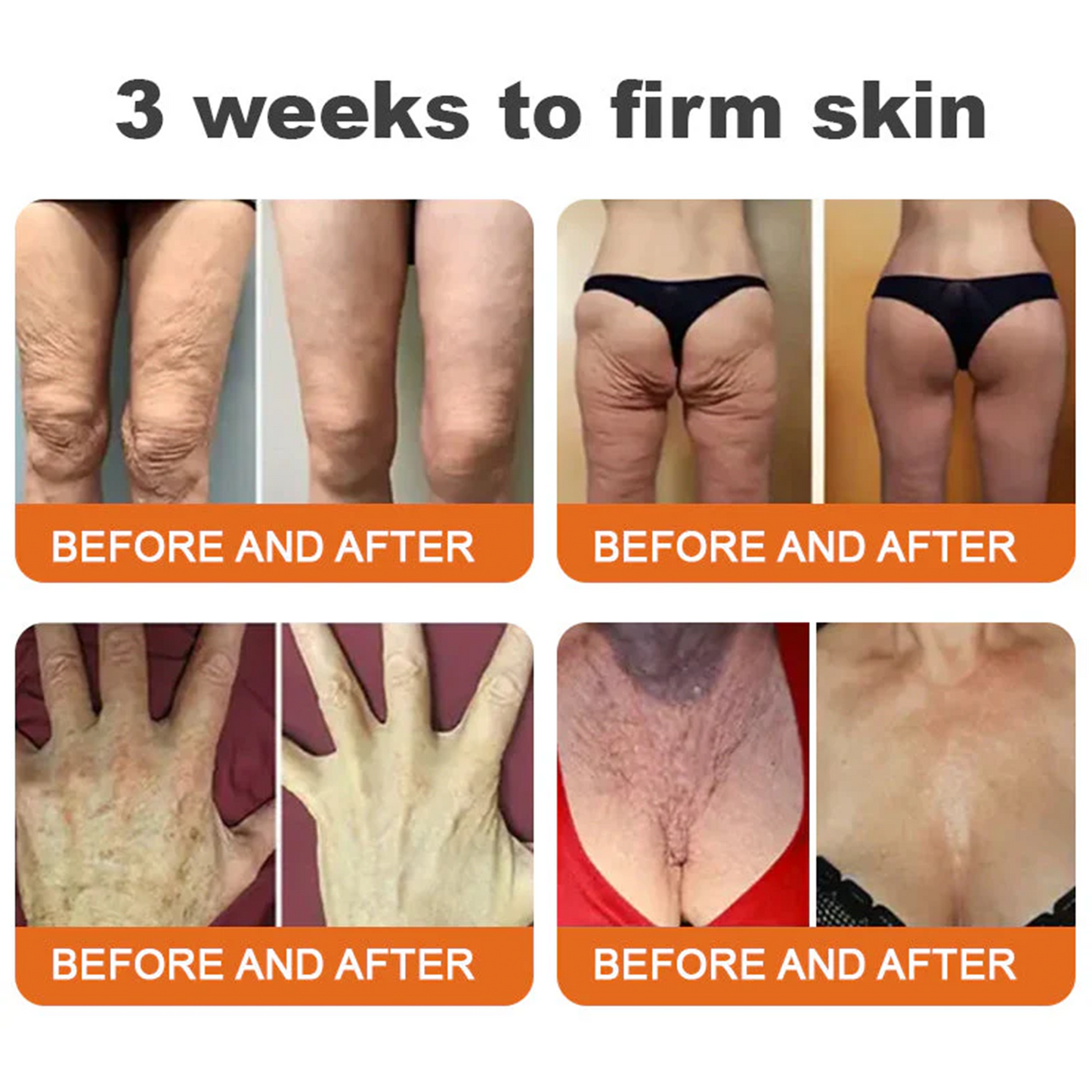 👨‍⚕️Dermatologist Recommended👨‍⚕️: Rolimey® Bee Venom Advanced Skin Rescue — Specifically Formulated for Paper-Thin, Fragile & Easy-Bruising Skin — 🔥Limited Time 80% OFF🔥