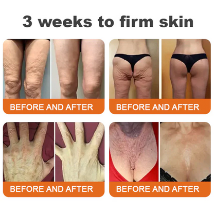 👨‍⚕️Dermatologist Recommended👨‍⚕️: Rolimey® Bee Venom Advanced Skin Rescue — Specifically Formulated for Paper-Thin, Fragile & Easy-Bruising Skin — 🔥Limited Time 80% OFF🔥