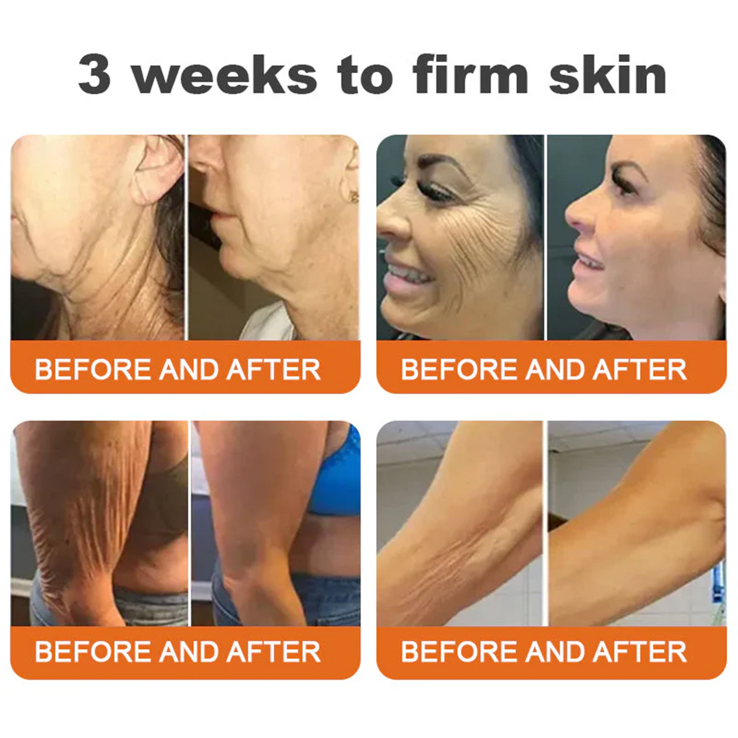 👨‍⚕️Dermatologist Recommended👨‍⚕️: Rolimey® Bee Venom Advanced Skin Rescue — Specifically Formulated for Paper-Thin, Fragile & Easy-Bruising Skin — 🔥Limited Time 80% OFF🔥
