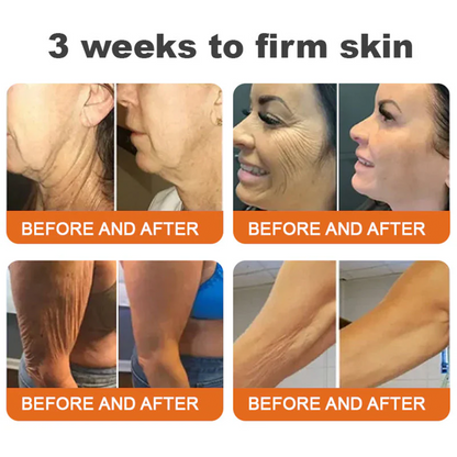 👨‍⚕️Dermatologist Recommended👨‍⚕️: Rolimey® Bee Venom Advanced Skin Rescue — Specifically Formulated for Paper-Thin, Fragile & Easy-Bruising Skin — 🔥Limited Time 80% OFF🔥