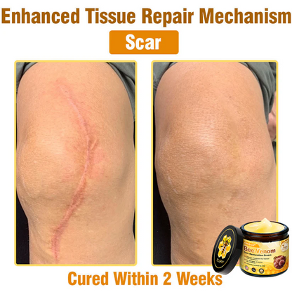 FDA Approved: Ourlyard® Bee Venom Skin Restoration Cream — 🔥Limited Time 80% OFF🔥