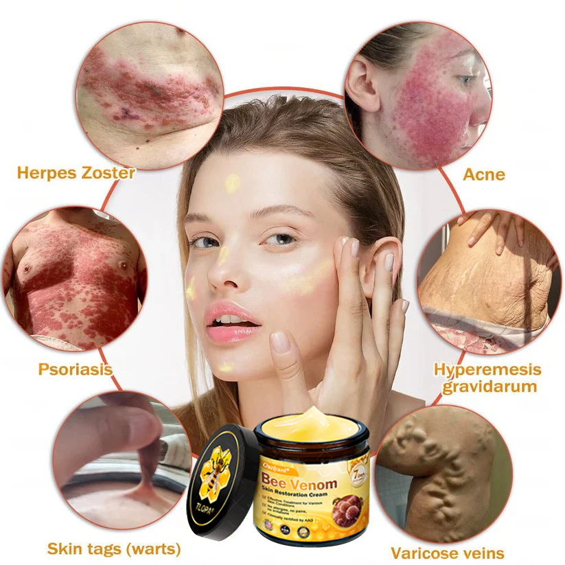 FDA Approved: Ourlyard® Bee Venom Skin Restoration Cream — 🔥Limited Time 80% OFF🔥
