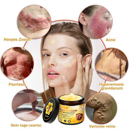 FDA Approved: Ourlyard® Bee Venom Skin Restoration Cream — 🔥Limited Time 80% OFF🔥