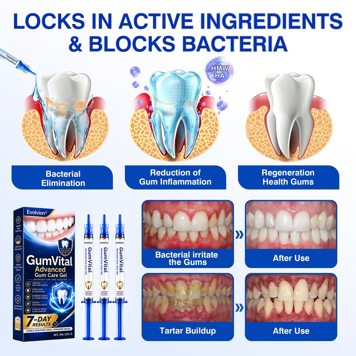 ❤️🦷Evolvion® GumVital Advanced Gum Care Gel🛡️🎁