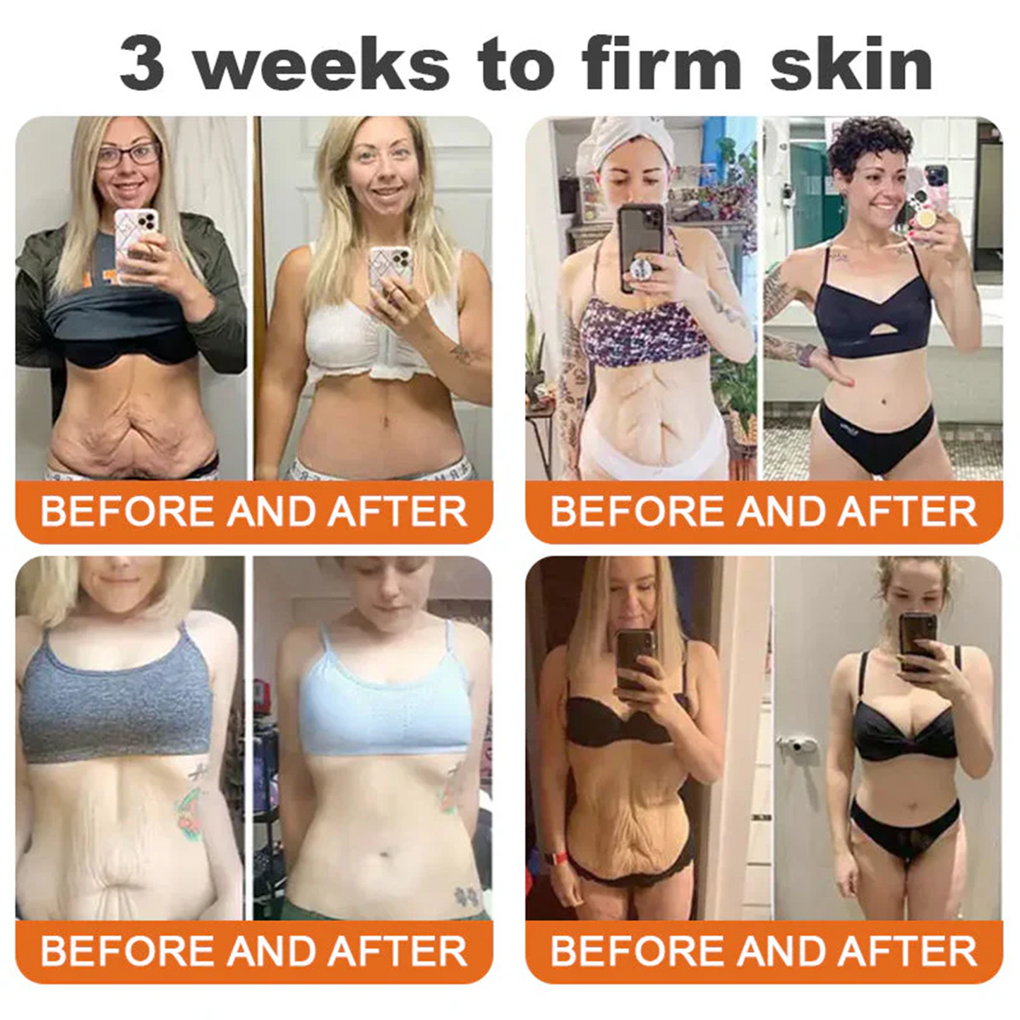 👨‍⚕️Dermatologist Recommended👨‍⚕️: Rolimey® Bee Venom Advanced Skin Rescue — Specifically Formulated for Paper-Thin, Fragile & Easy-Bruising Skin — 🔥Limited Time 80% OFF🔥