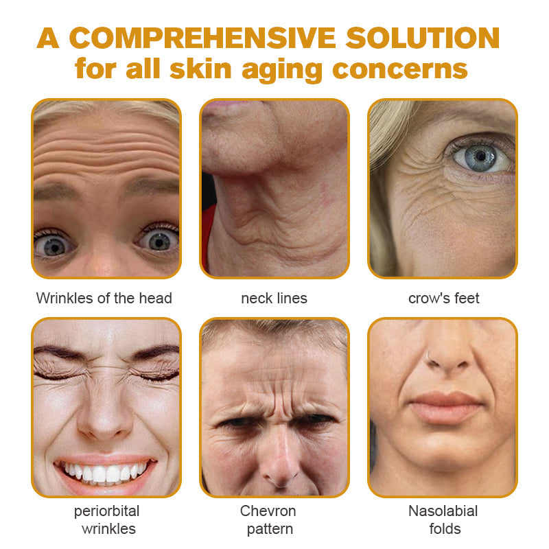 (🌤️Made and Shipped from USA✅) 🌟Furzero™ c Wrinkle Removal Cream- LAST DAY 70% OFF