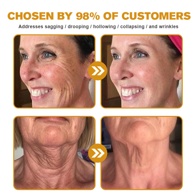 (🌤️Made and Shipped from USA✅) 🌟Furzero™ c Wrinkle Removal Cream- LAST DAY 70% OFF