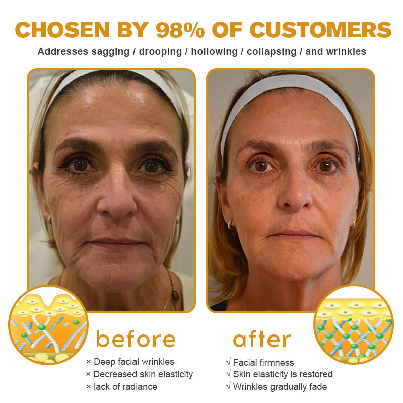 (🌤️Made and Shipped from USA✅) 🌟Furzero™ c Wrinkle Removal Cream- LAST DAY 70% OFF