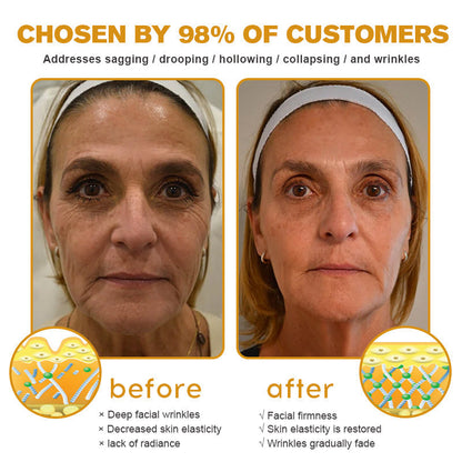 (🌤️Made and Shipped from USA✅) 🌟Furzero™ c Wrinkle Removal Cream- LAST DAY 70% OFF